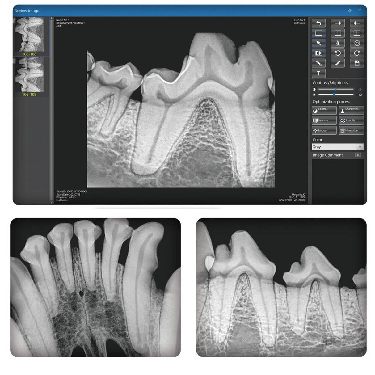 Dental-Röntgengerät TT-32DX