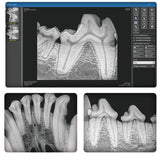 Dental-Röntgengerät TT-32DX
