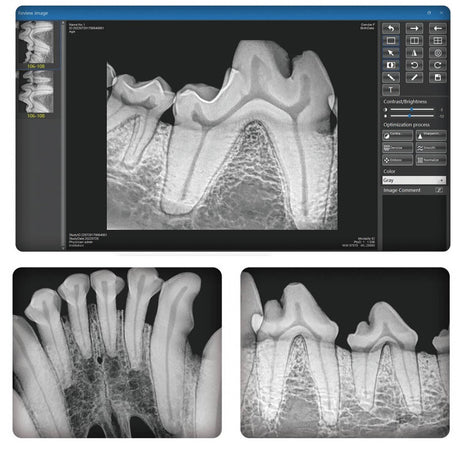 Dental-Röntgengerät TT-32DX